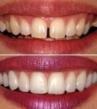 Victorian Dental Before and After