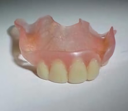 Valplast partial done by Victorian Dental
